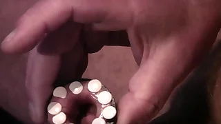 Dilatation my foreskin